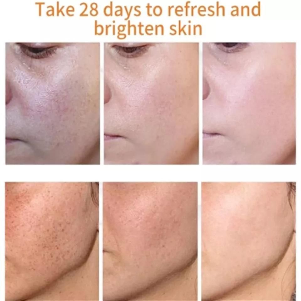 Effective Whitening Freckle Cream